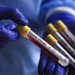 RDC/Ebola : Plus de 1.500 cas confirmés