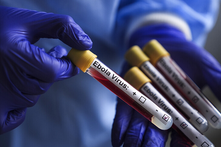 RDC/Ebola : Plus de 1.500 cas confirmés